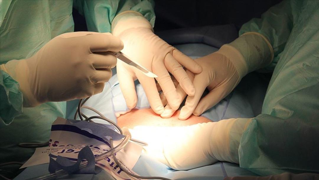 Parlamento kabul edildi: Organ bağış süreçlerinde dönüşüm başlıyor! Organ bağış dönemi e-devlet aracılığıyla geliyor: bağışçılar önceliğe sahip olacak ... 3